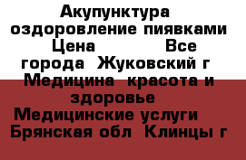 Акупунктура, оздоровление пиявками › Цена ­ 3 000 - Все города, Жуковский г. Медицина, красота и здоровье » Медицинские услуги   . Брянская обл.,Клинцы г.